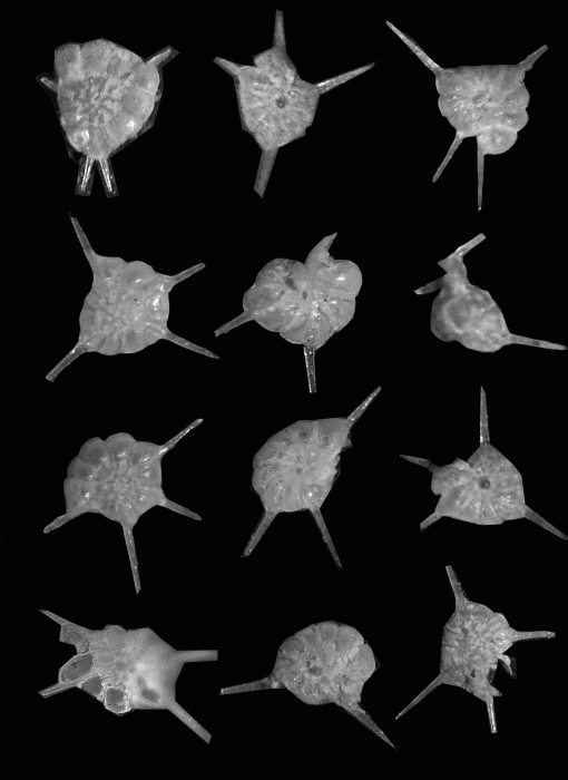 Asterorotalia trispinosa (Thalmann, 1933) Asterorotalia trispinosa (Thalmann, 1933)