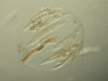 Ctenophora (sea gooseberries)