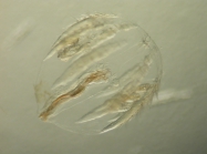 plankton cf Pleurobrachia sp. 2h