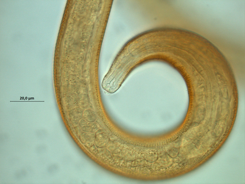 Calomicrolaimus compridus, head region