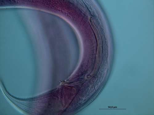 Dorylaimopsis sp., spicules