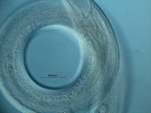 Dorylaimopsis, detail spicules + cuticle